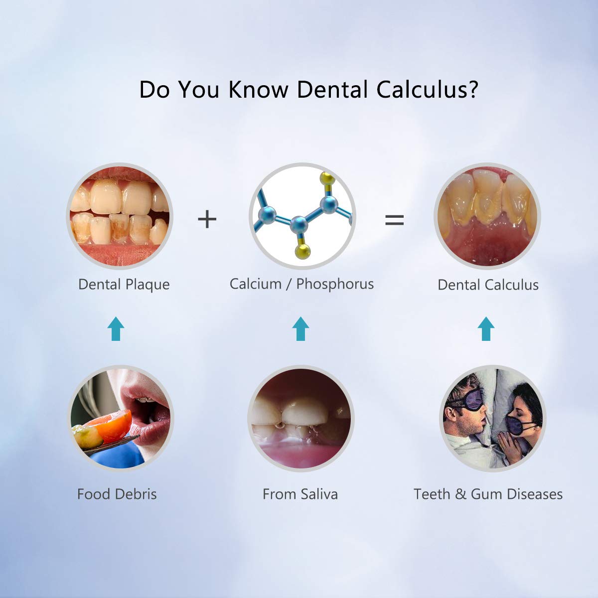 iFanze Electric Dental Calculus Remover